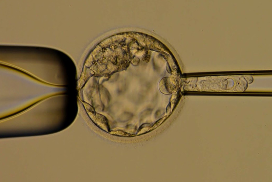 Embryo Biopsy