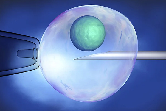Laser Assisted Hatching